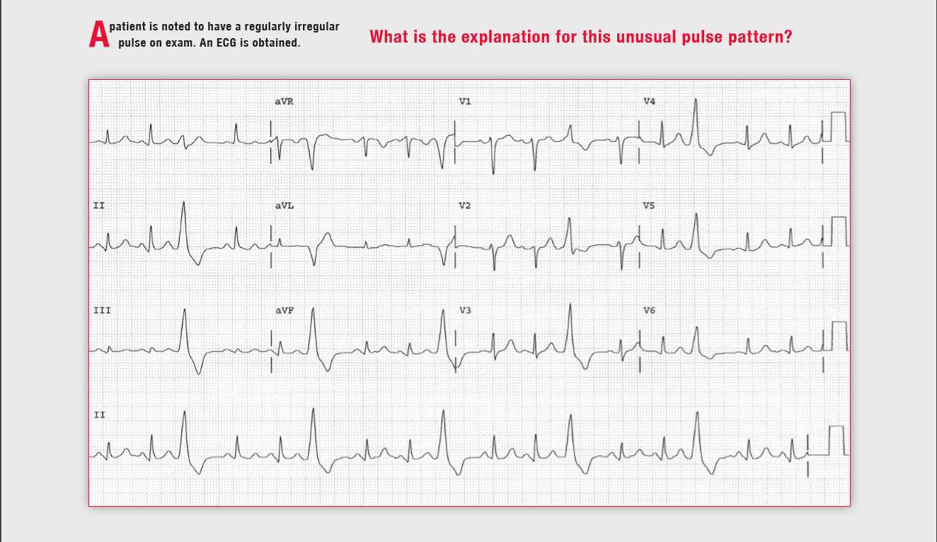 室早三联律是什么原因造成的,读心有术讲的是什么