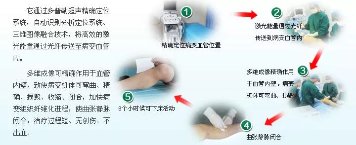 腿上有蚯蚓是什么症状,大腿有蚯蚓怎样治疗