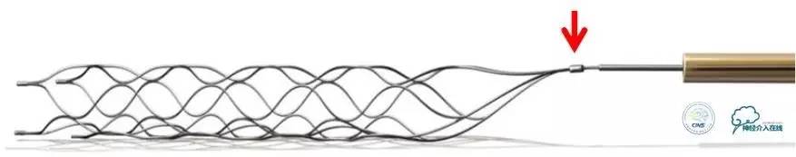 急性缺血性卒中静脉溶栓2018指南,急性缺血性卒中血管内再通标准