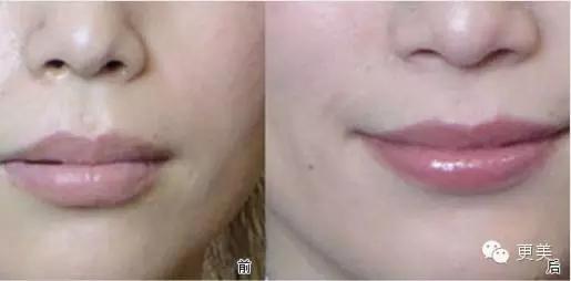 韩式半永久,韩式半永久都有什么