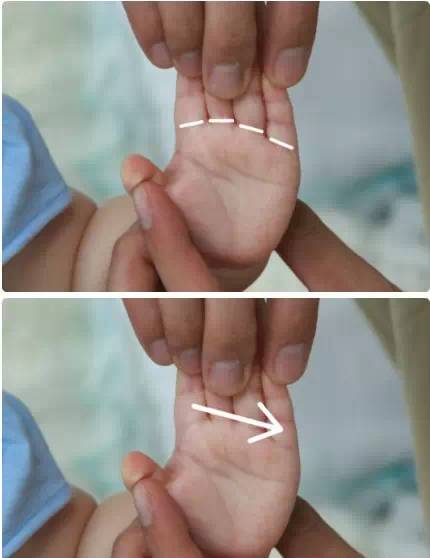 小儿推拿教程带视频的书,小儿推拿止咳化痰手法图解