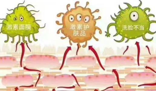 激素脸擦护肤品刺痛是怎么回事,激素脸洗脸会刺痛吗