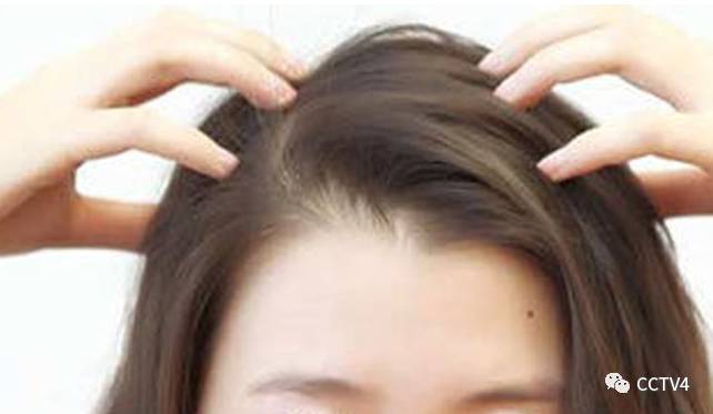秋季脱发严重怎么补救,秋季季节性脱发怎么办