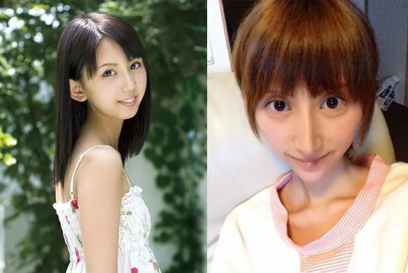 香港最老明星整容失败照片对比,整容失败的明星有哪些