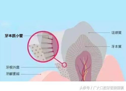 牙槽骨萎缩是什么症状,牙齿太久不咀嚼会牙槽骨萎缩吗