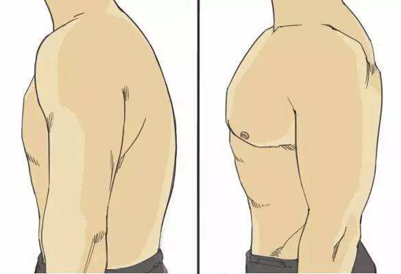 小技巧解决肩膀疼痛视频,关节炎肩膀疼痛解决最好办法