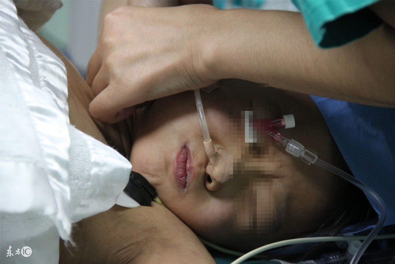 宝妈剖腹产注意哪些,剖腹产需要知道的事项