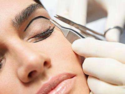 二次修复双眼皮恢复过程,二次修复双眼皮的过程