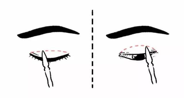 肿眼泡双眼皮贴正确的贴法,蕾丝双眼皮贴正确的贴法