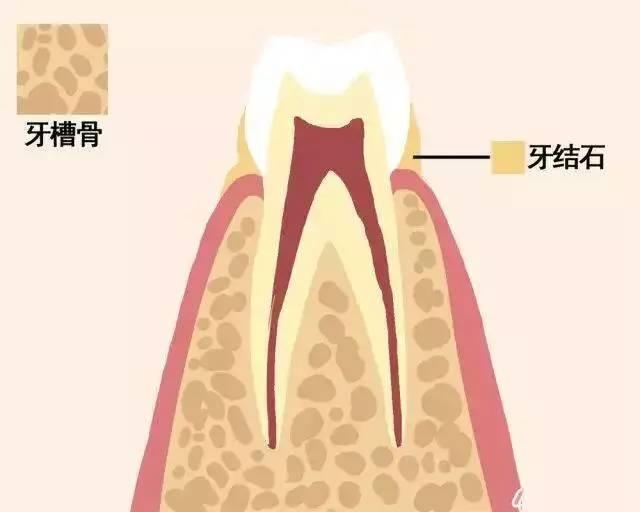 45岁以后牙齿为什么变得松动,牙齿全都松动了是不是生命有危机