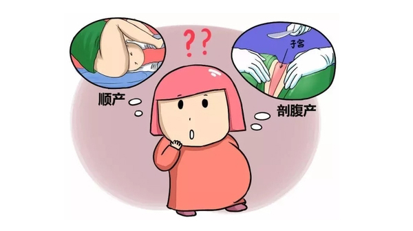 能顺产尽量顺产吗,孕妇能自由选择剖腹产跟顺产吗