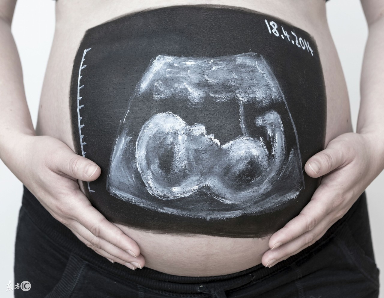 产前诊断孕前一周b超是什么,b超二级产前筛查