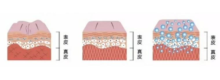 睡觉时也要争分夺秒变美！精致女人都在用会做睡眠spa的美颜枕套