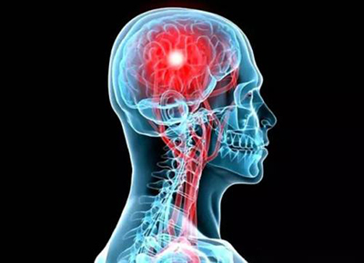 量子细胞肽预防脑血栓,对大众健康起到至关重要的作用