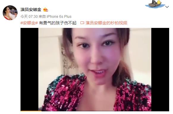 自称三国混血的安娜金和侯耀华三胞胎外甥女做的是同款脸吧?