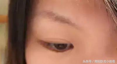 南阳时光微整形,南阳时光整形好还是天后整好