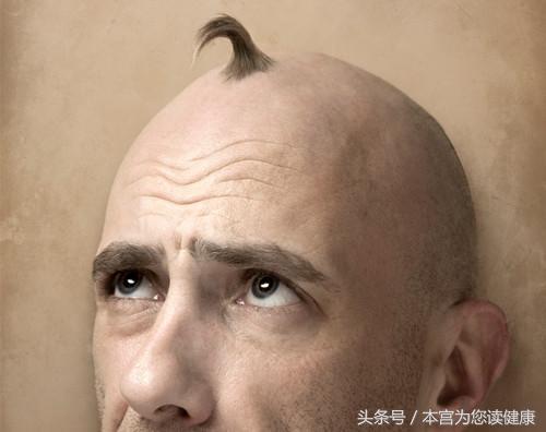 洗头大把掉发什么原因,为什么每次洗头都很会掉头发