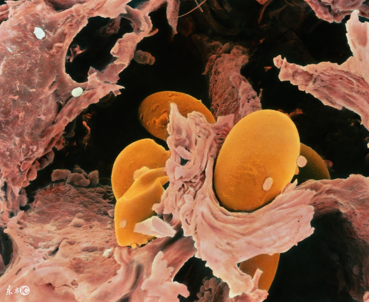 草鱼疥疮病的防治,疥疮防治意见