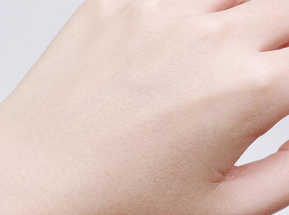 自然保湿芦荟胶除痘印吗,官方正品芦荟胶保湿舒缓祛痘印