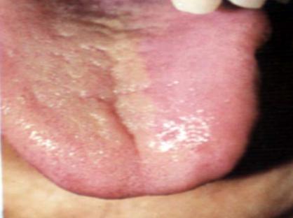 蒲辅周讲舌诊,蒲辅周怎么看舌诊