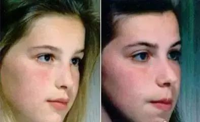 纠正张嘴呼吸会变丑的方法,张嘴睡觉鼻子呼吸会变丑吗