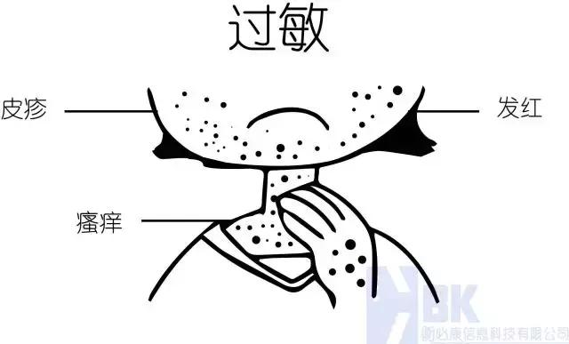 怎样增强抵抗力和免疫力不过敏,皮肤过敏怎么增强免疫力