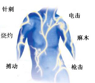 带状疱疹后神经痛后遗症自我修复,带状疱疹神经痛镇痛药