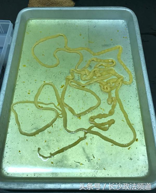 体内有七米长绦虫,7米长寄生虫