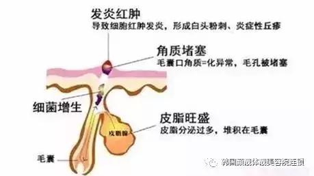冬季皮肤干燥起皮泛红怎么办,冬季皮肤干裂脱皮怎么办