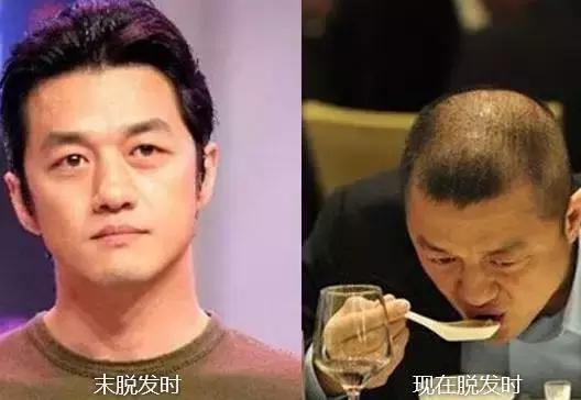 洗发水里面有害成分有哪些,洗发水里有什么成分会导致过敏