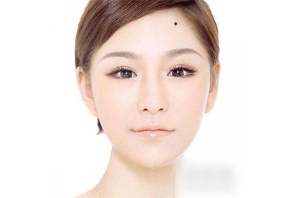 痣癌变后是什么癌症,痣突然凸起会是癌症吗