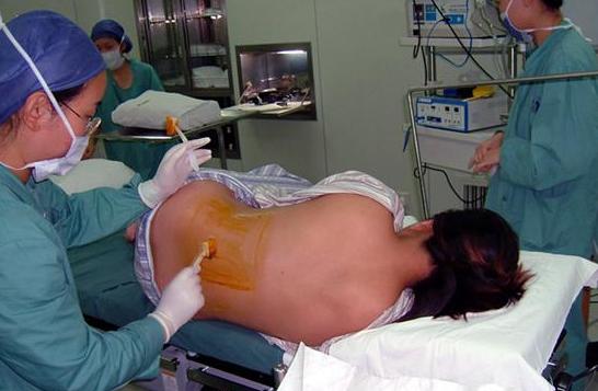 经历了剖腹产才知道妈妈的不容易,看了剖腹产才明白妈妈是多么伟大