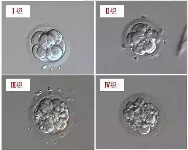 试管婴儿细胞分裂有碎片,试管婴儿胚胎碎片多是什么原因