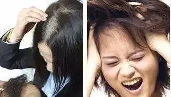 洗发水里面有害成分有哪些,洗发水里有什么成分会导致过敏