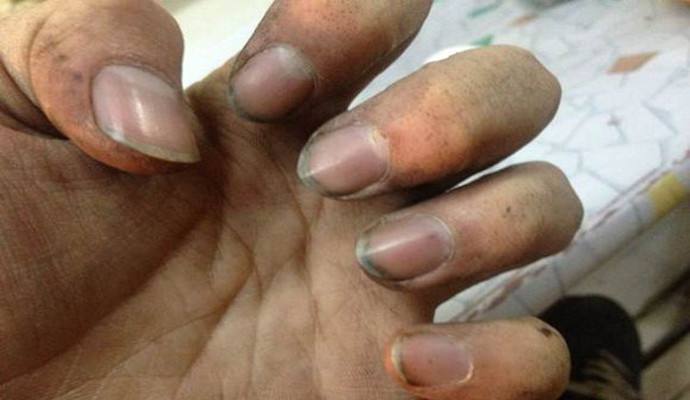 人体最脏的十大部位是哪,人体最脏的4个部位