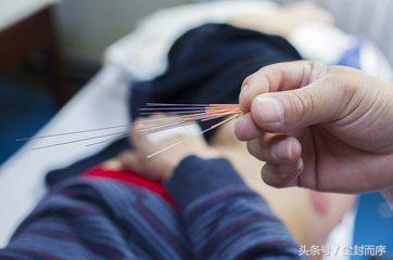 针灸养生可以让人运气好吗,经常做针灸对身体有什么好处