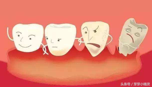 塞牙的原因和治疗方法,塞牙的罪魁祸首和危害你知道吗