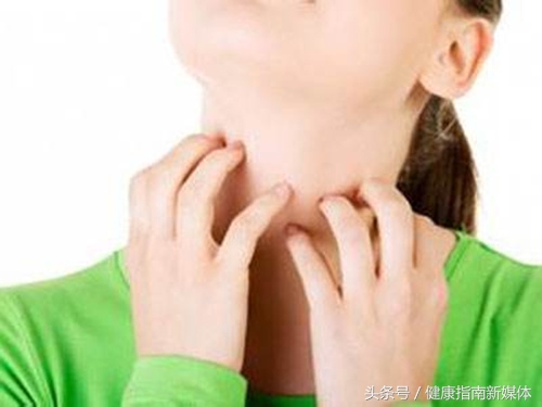 对称性神经性皮炎治疗,治疗神经性皮炎的软膏