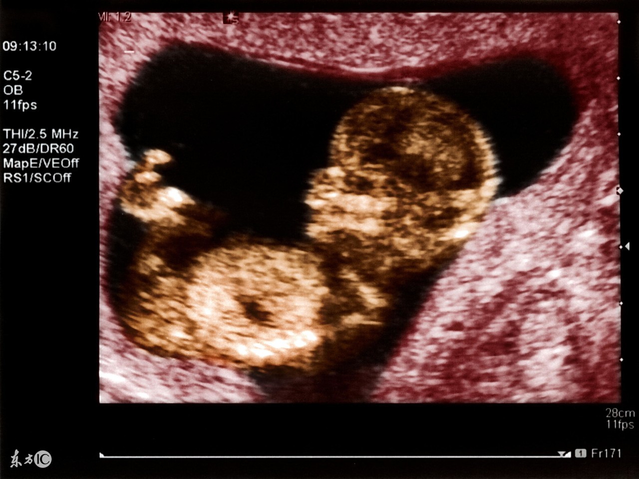 四维彩超那点事儿!准妈妈可能不知道,医生也不会告诉你!