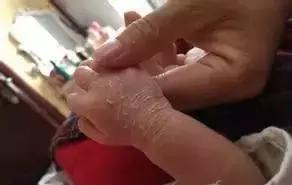 不要慌！新生宝宝这21种情况不是病！「爱贝佳月嫂讲堂」