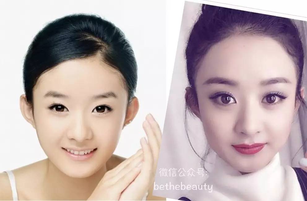 男生脸大怎么变小脸不整容,不靠化妆整容能把脸部骨骼变美