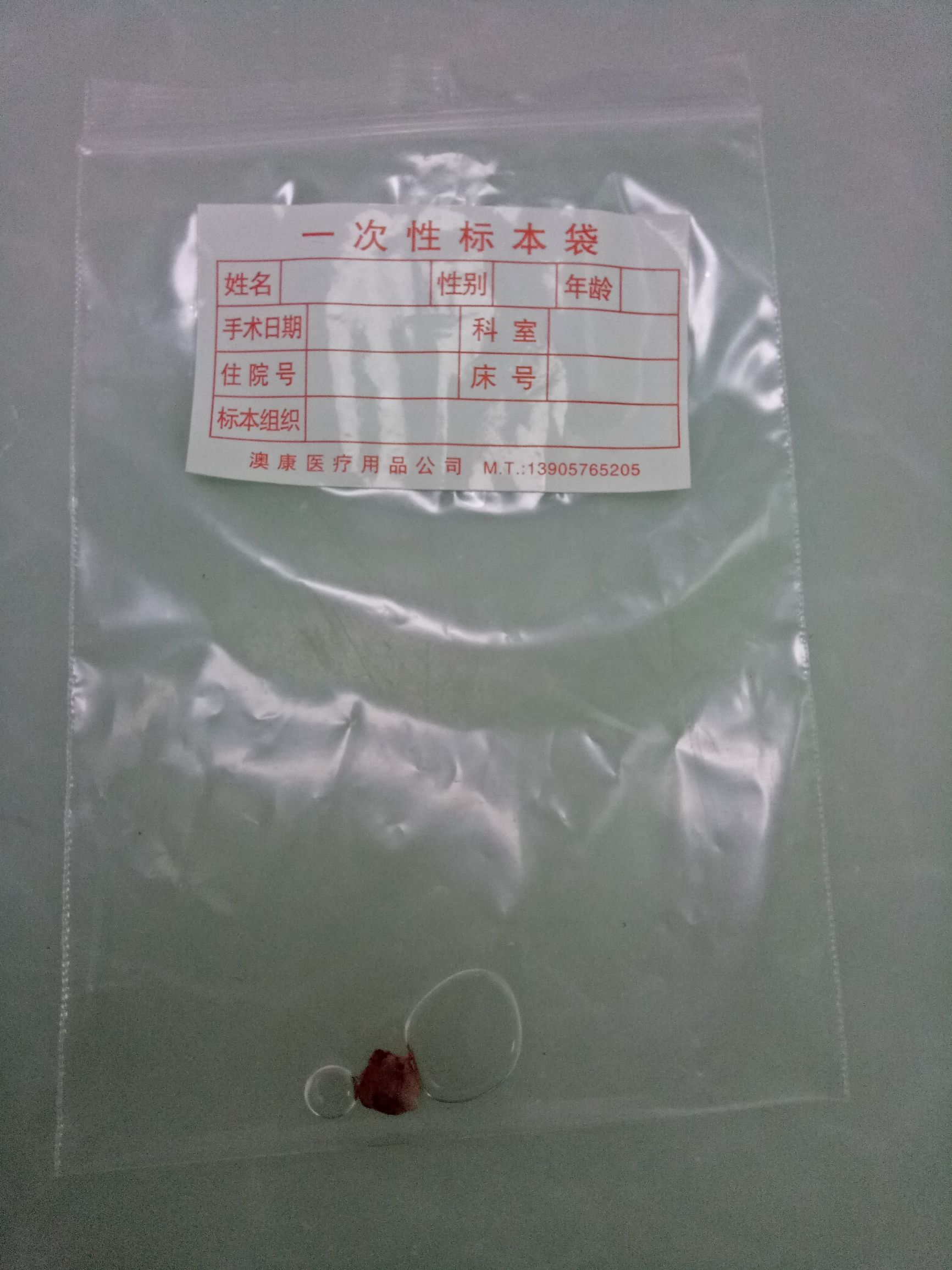 男人肩上扛着痣好吗,肩上扛痣的人是不是很苦