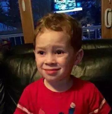 美瞳劣质,劣质美瞳的曝光