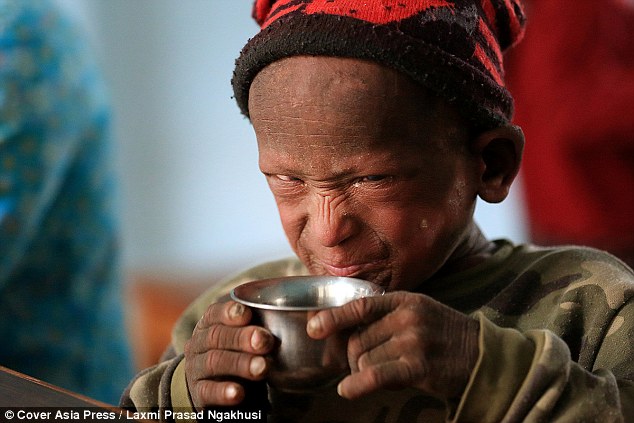 小男孩一出生无鼻无耳无眼,小男孩一出生奇丑无比