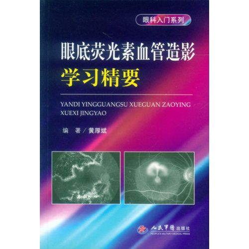 脉络膜上腔出血是怎样的症状,自发性蛛网膜下腔出血的临床表现
