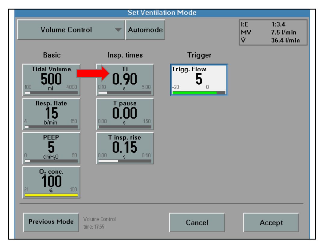 呼吸机基础知识最终版,呼吸机临床设置方法