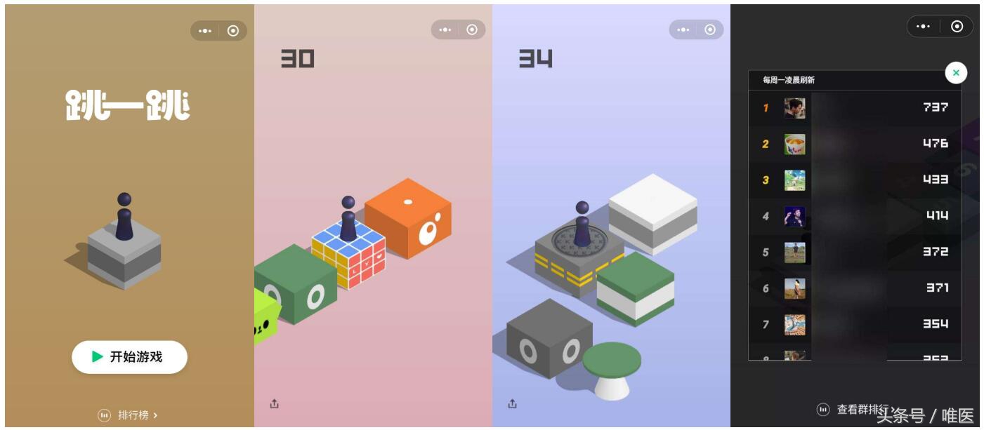 腱鞘炎治疗过程疼到尖叫视频,腱鞘炎跳一跳