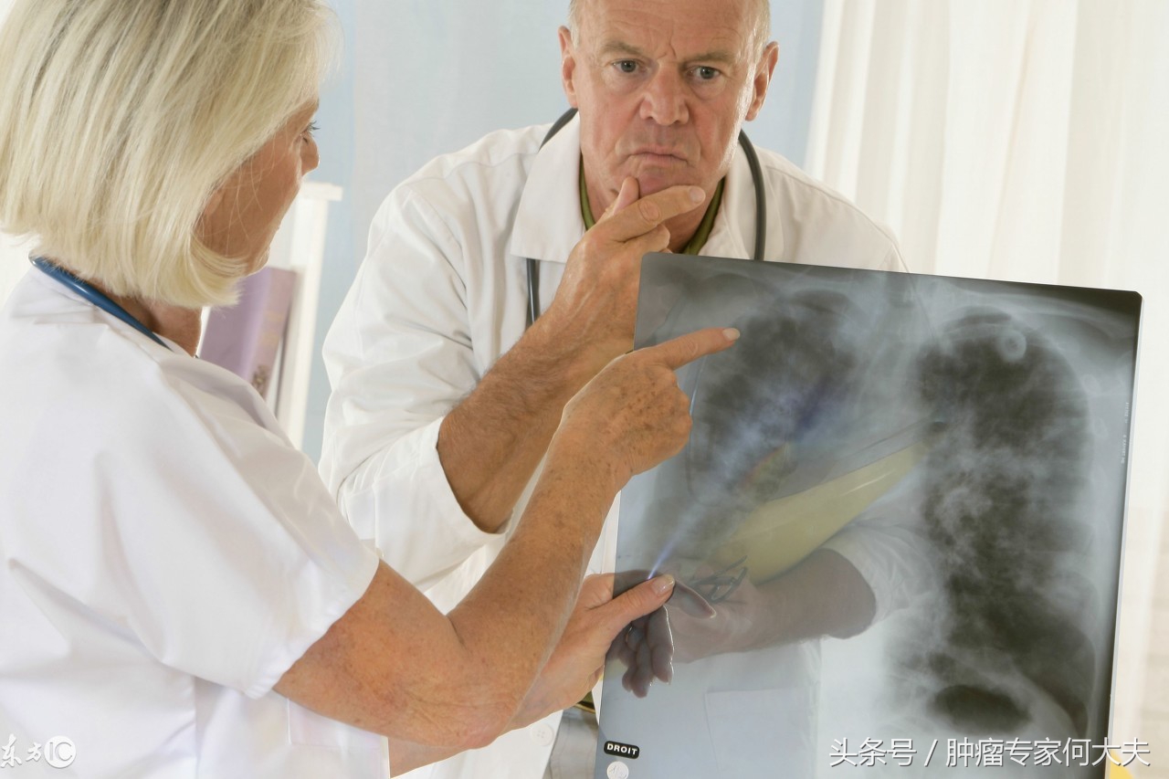 上腔静脉综合征是癌症吗,肿瘤造成上腔静脉梗阻怎么缓解