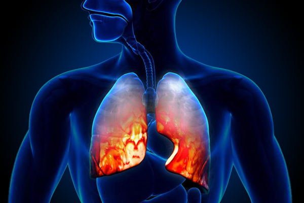 pd1联合化疗治肺癌最新数据,重大突破pd-1
