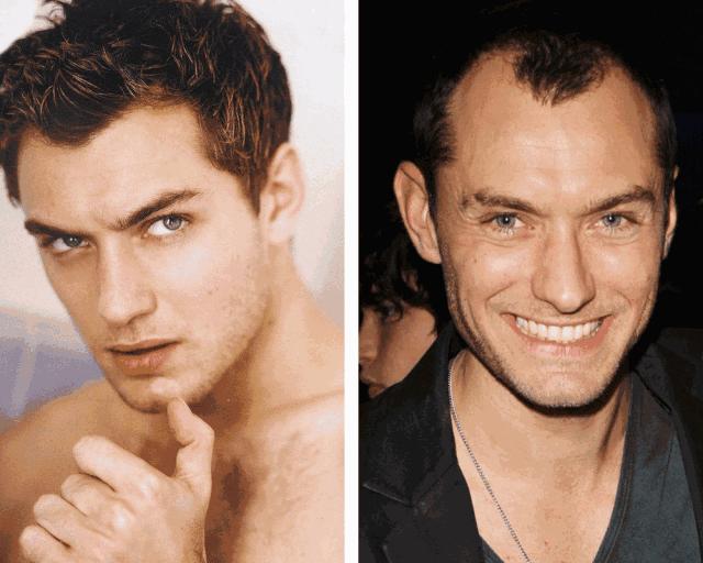 真正有效的防脱洗发水,终于找到一款好用的洗发水文案